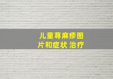 儿童荨麻疹图片和症状 治疗